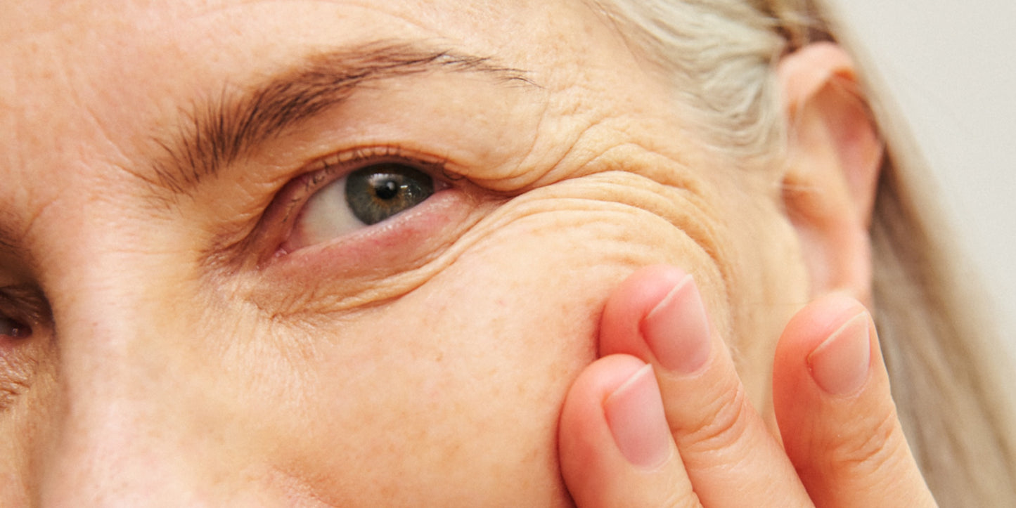 Dry vs dehydrated skin: what’s the difference?