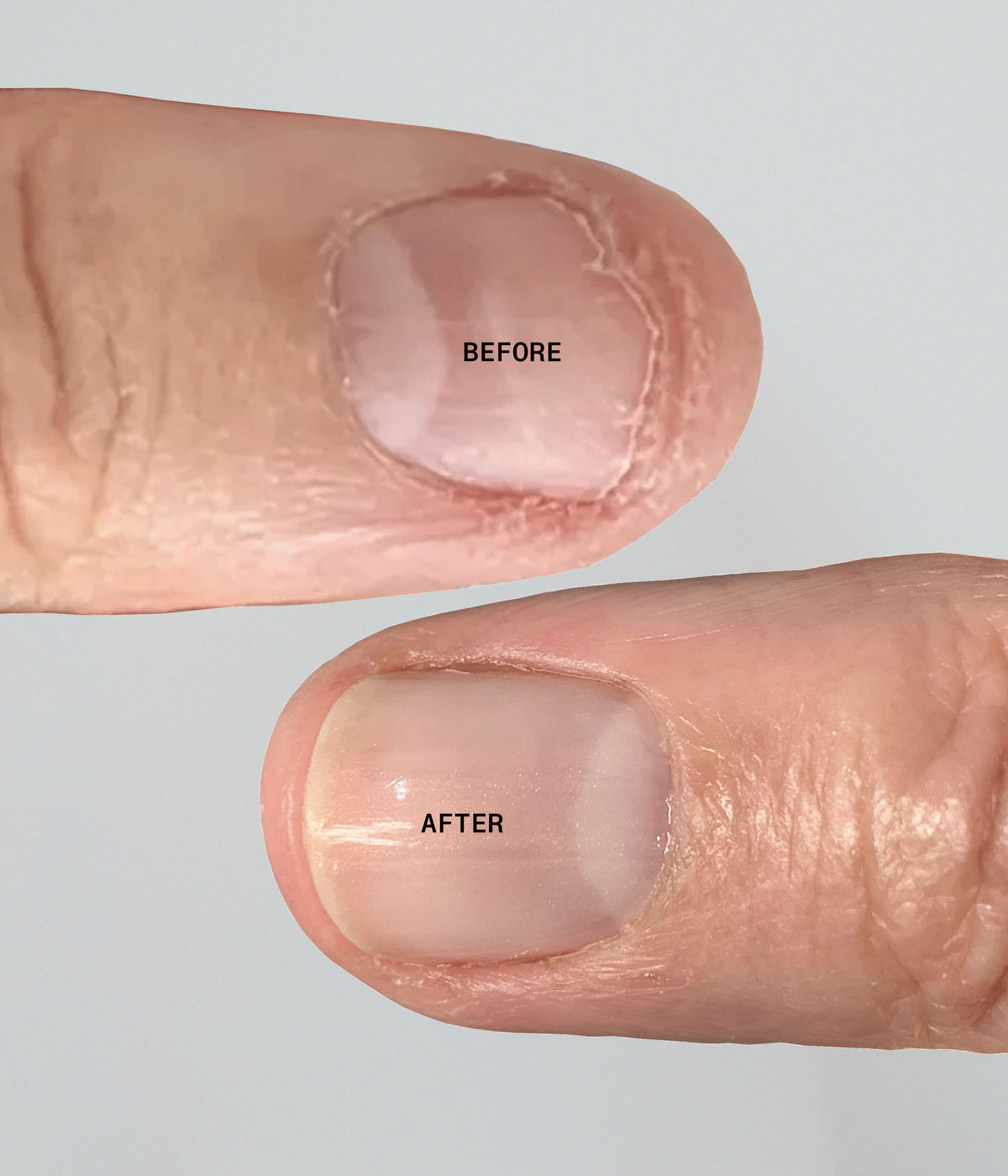 Ultimate Nail Rescue